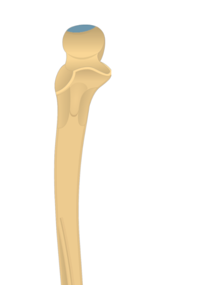 <p>What is this pointing to? What bone is it on?</p>