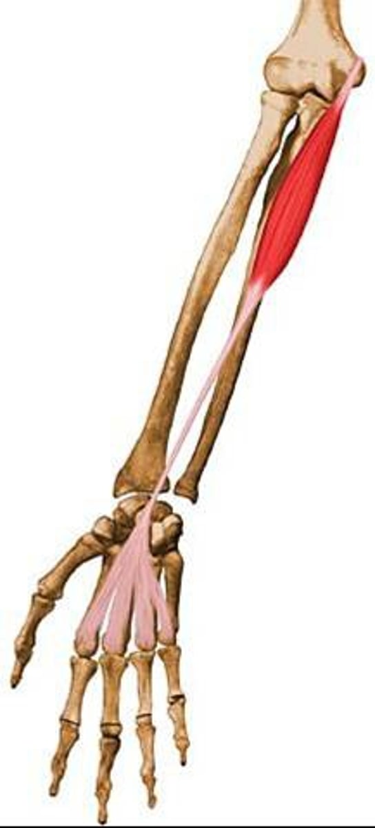 <p>Common flexor tendon</p>