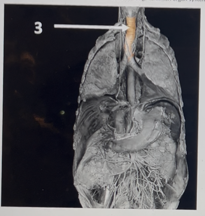 <p>The structure indicated by the arrow at Label 3 belongs to which organ system?</p>