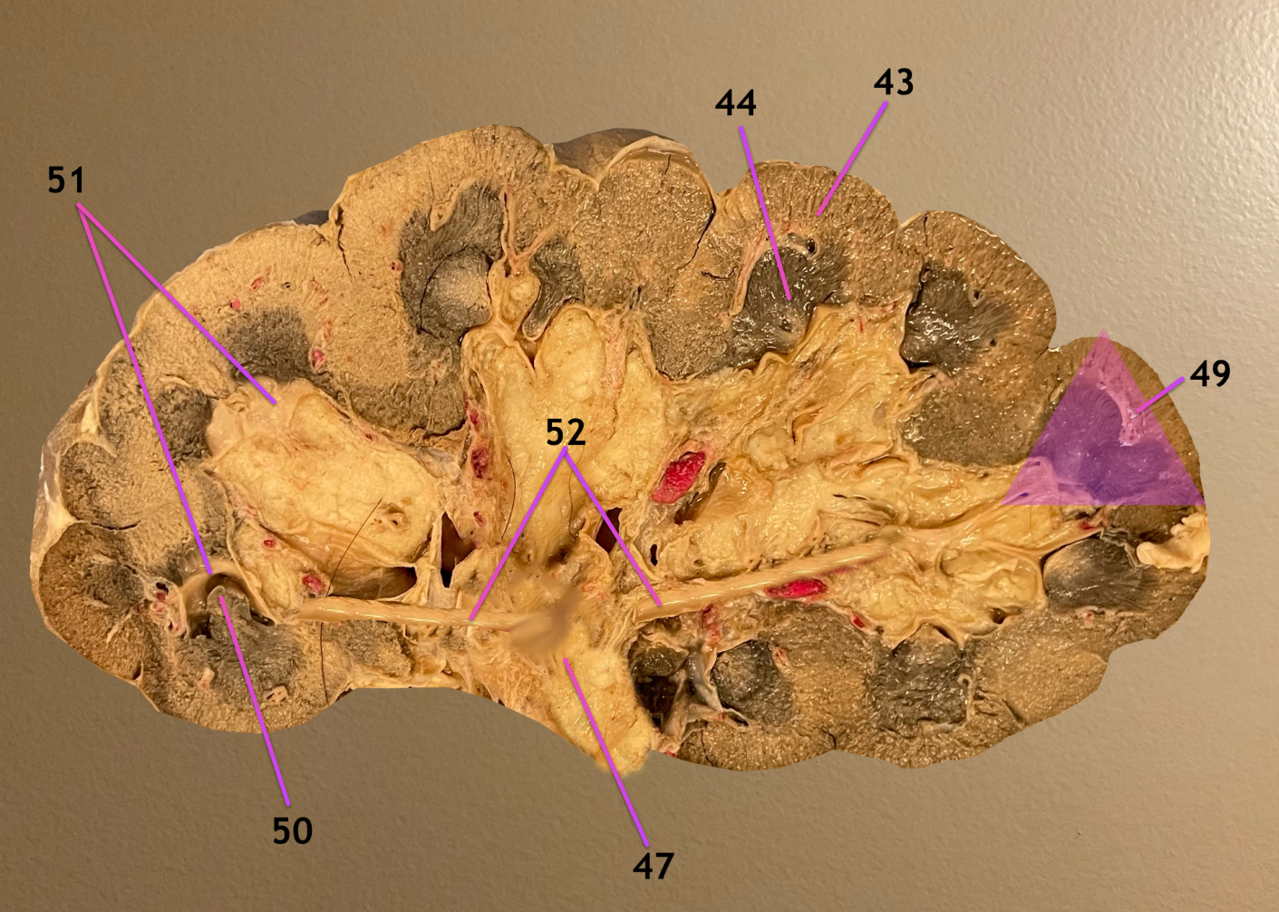 <p>longitudinal section of kidney</p><p>.</p><p>label the topographic regions 43, 44</p><p>.</p><p>label 47, 49-52</p><p>include both names of 52</p>