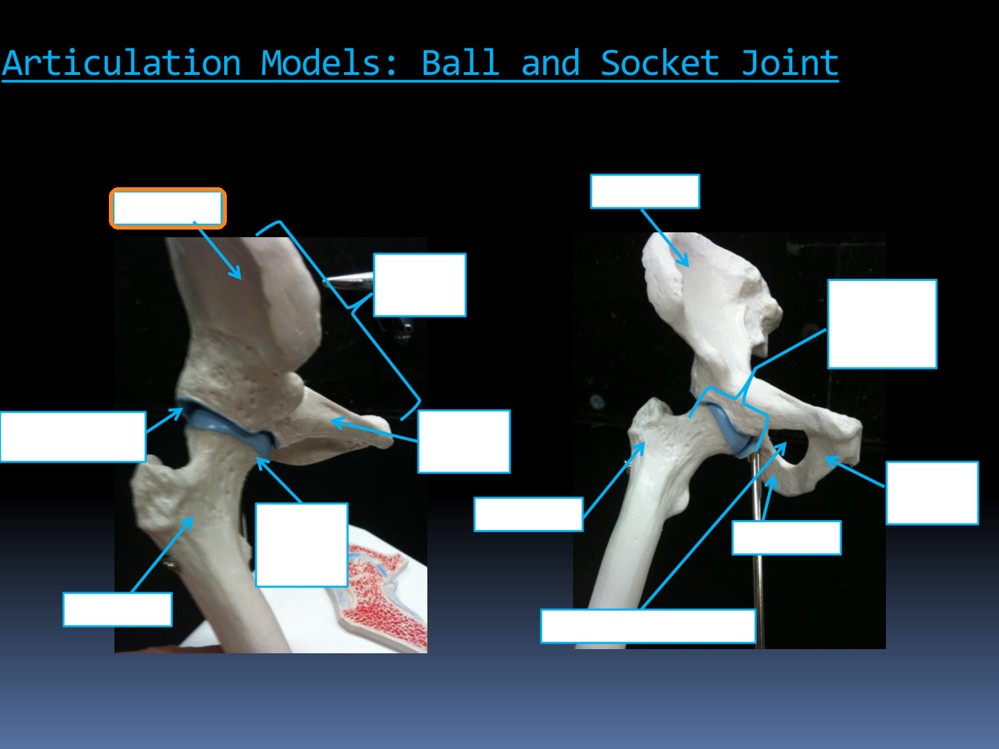 <p>Identify the highlighted structure in the Hip Articulation Models diagram.</p>