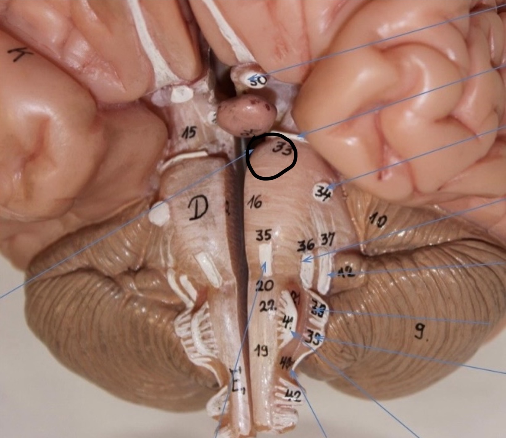 <p>Identify the circled area?</p>