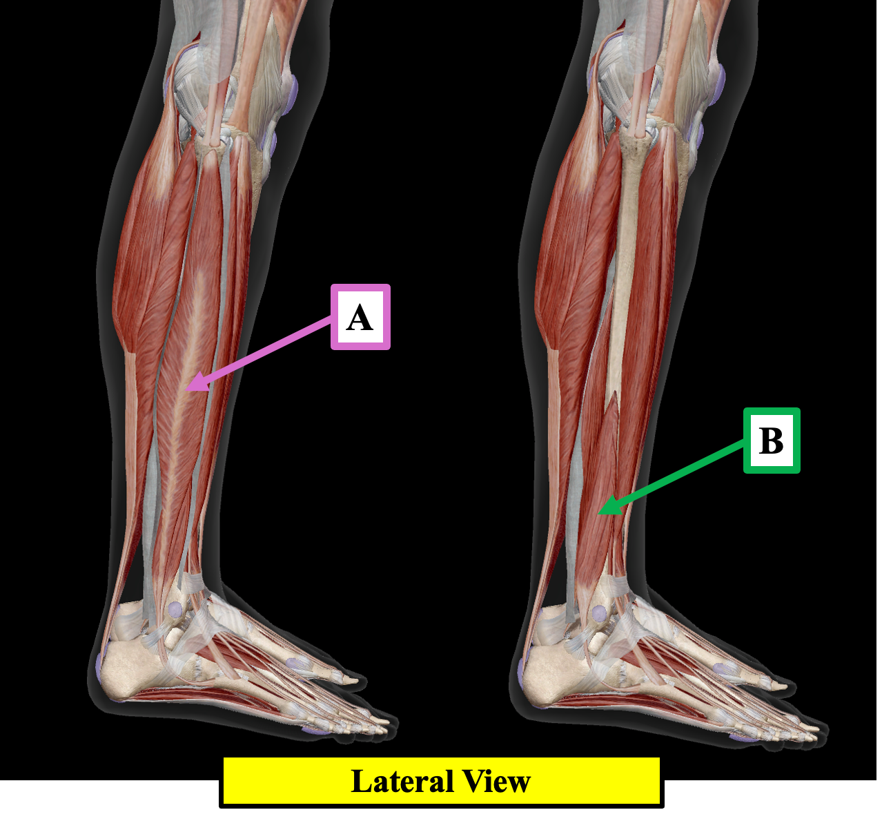 <p>Identify label A</p>