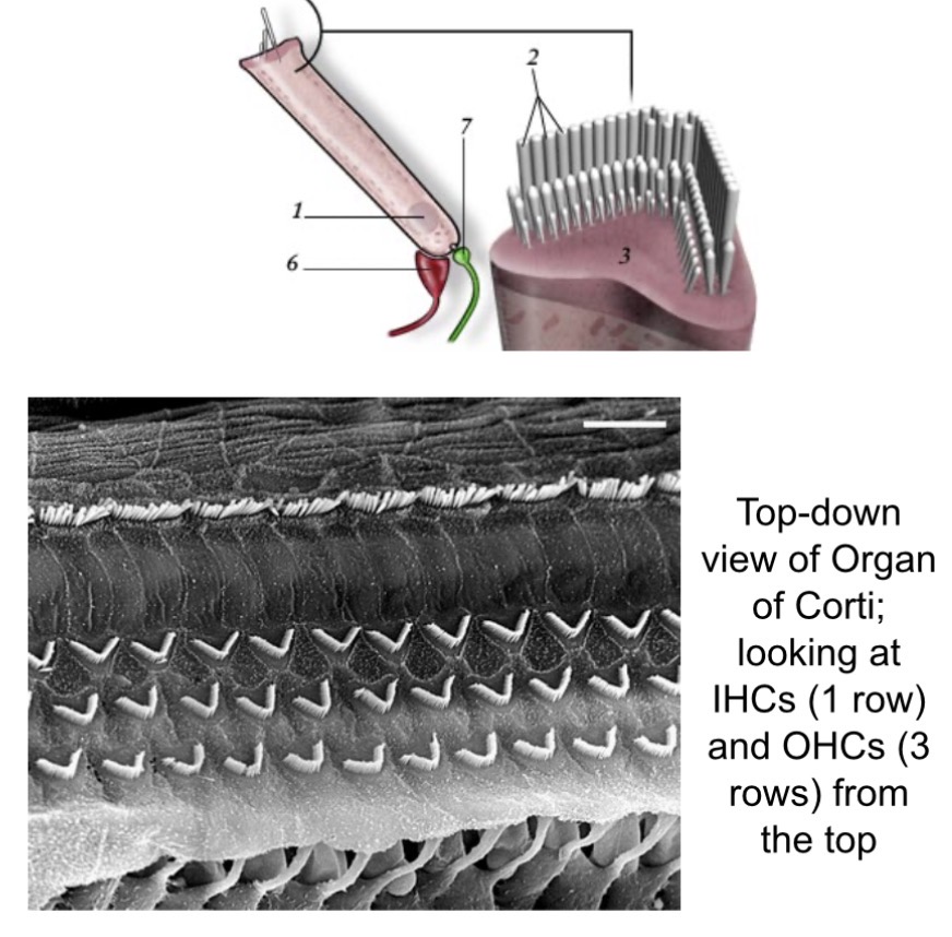 <p><span><span>Outer Hair Cells (OHCs)</span></span></p>