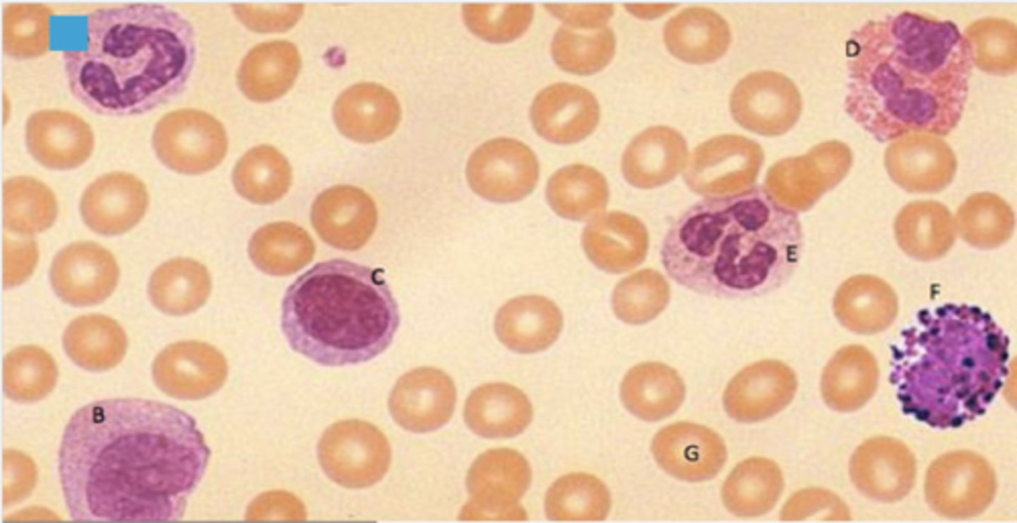 <p>Identify the following blood-formed element</p>