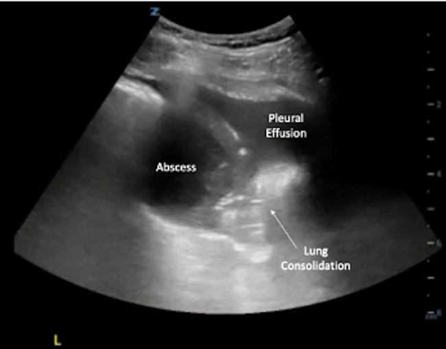 <p>What is this image demonstrating?</p>
