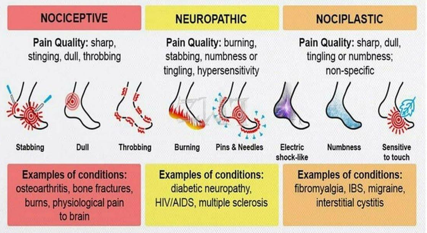 <ul><li><p>Pain quality: sharp, dull, tingling or numbness; non-specific</p><ul><li><p>ex. fibromyalia, IBS, migraine, interstitual cystitis </p></li></ul></li></ul><p></p>