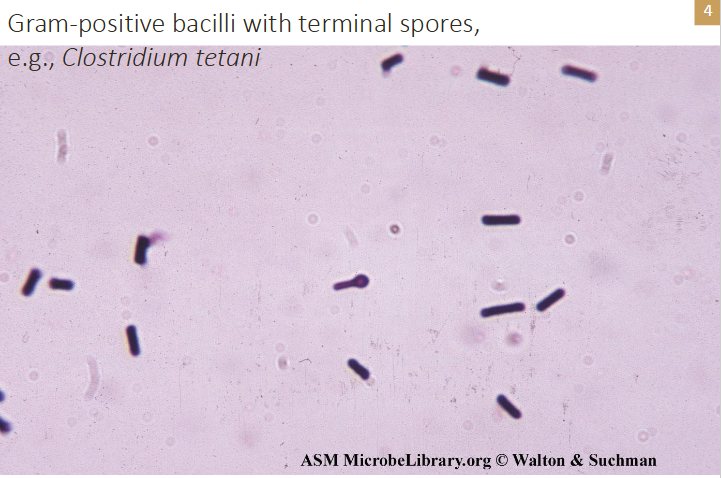 <p>e.g colstridium tetani</p><p>- look at the middle one it has a little bump on the terminal (end) its called having a terminal spore</p>