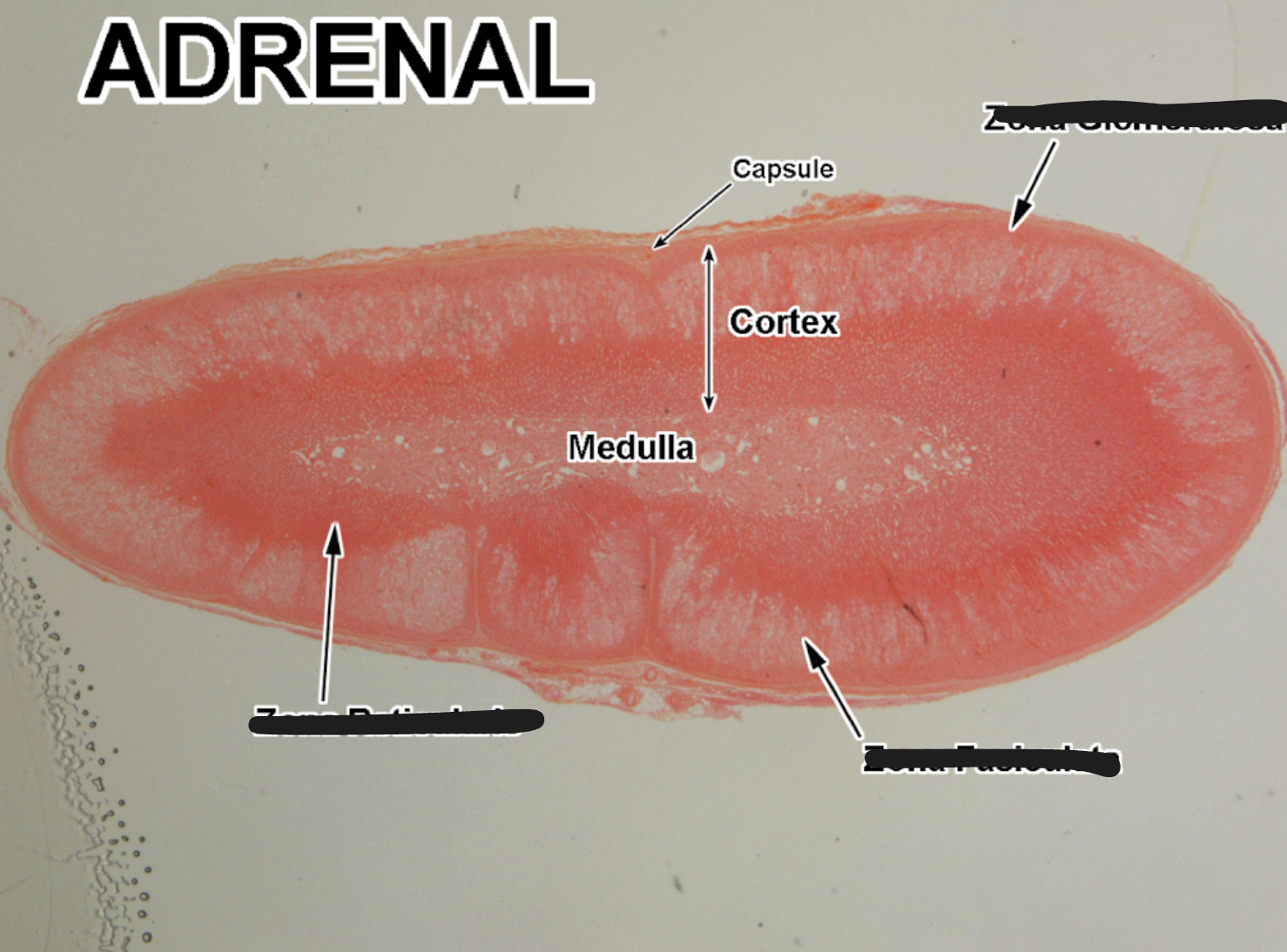 <p>1) Capsule</p><p>2) Cortex</p><p>3) Medulla</p>