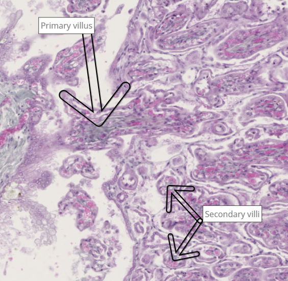 <ul><li><p>primary are cytotrophoblast cells covered byy syncytotrophoblast cells</p></li><li><p>secondary have a mesodermal core</p></li><li><p>both avasuclar</p></li></ul><p></p>