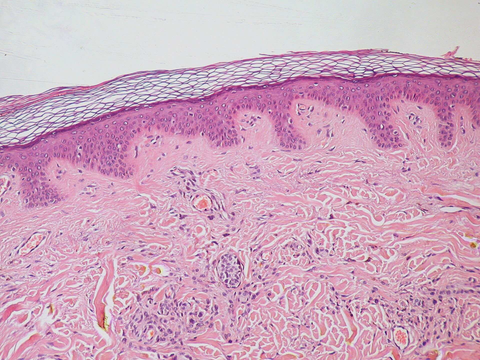 <p>Identifica la tinción y señala estructuras basofilas y eosinofilas</p>