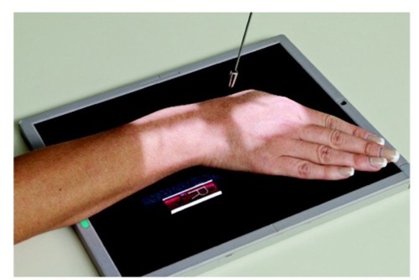 <p>S - shield on lap</p><p>T - 4.5 @ 60</p><p>A - 10 to 15 degrees toward elbow</p><p>M - correct marker on cassette</p><p>P - hand turned toward ulnar side w/ forearm straight, CR on scaphoid</p><p>S - 40</p><p>B - suspension</p><p>C - 10 x 12</p>
