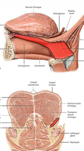 term image