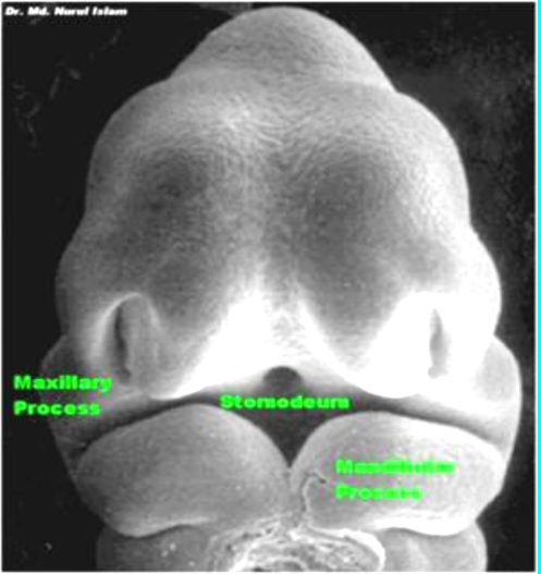 term image