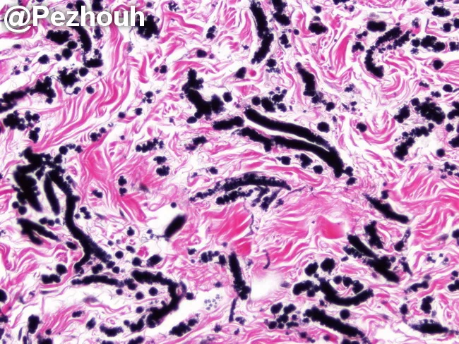<p>Verhoeff stain</p>