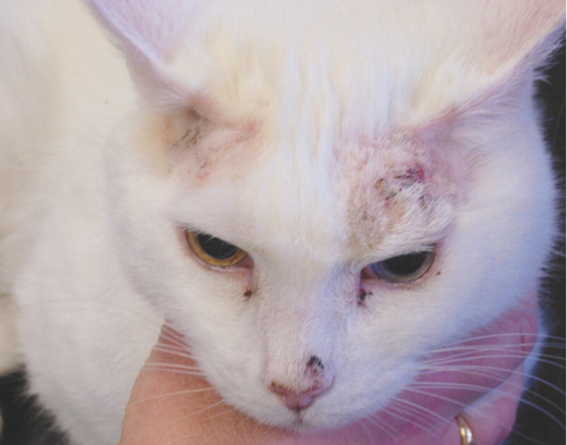 <p>Cutaneous Squamous Cell Carcinoma (SCC)</p>