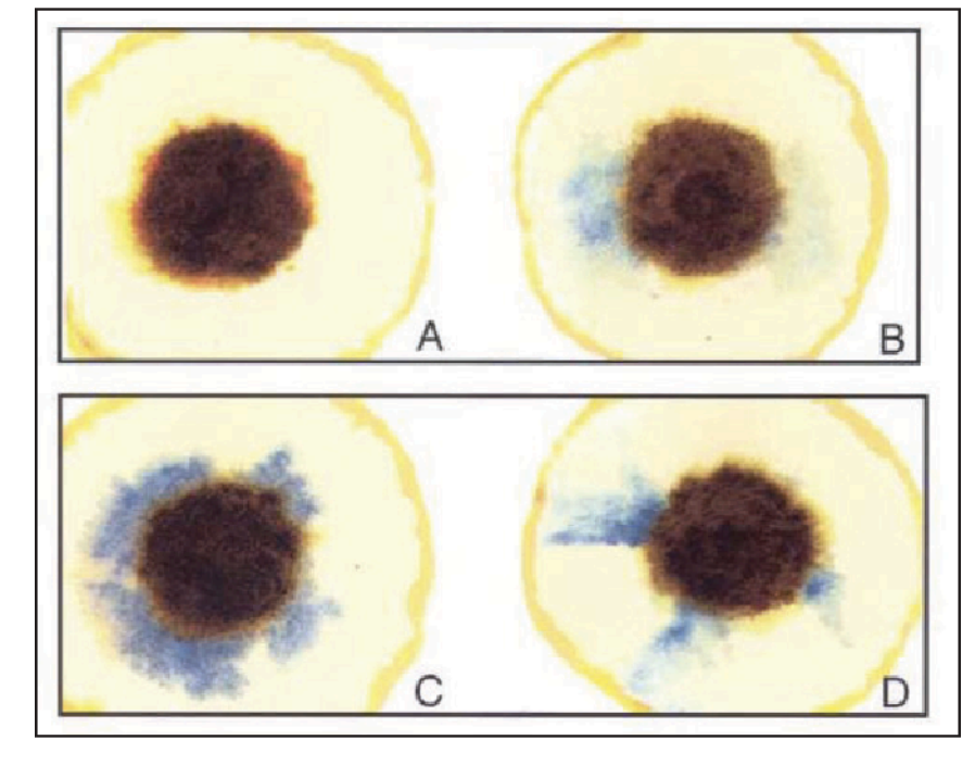 <p>false negative result due to what vitamin</p>