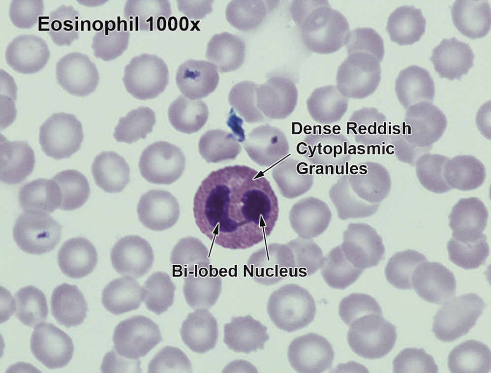 <p><span style="background-color: rgba(0, 0, 0, 0); line-height: 19.55px;">RED bi-lobed nucleus</span></p>