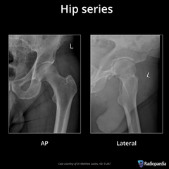 <p>What are the routine projections of the Hip?</p>