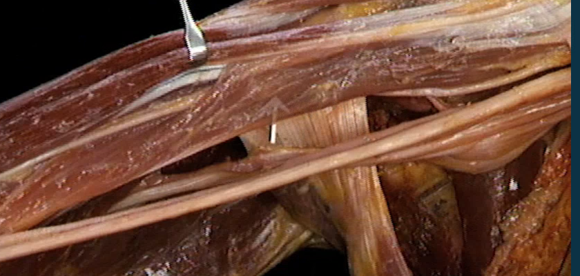 <p>Welke zenuw loopt door?</p>