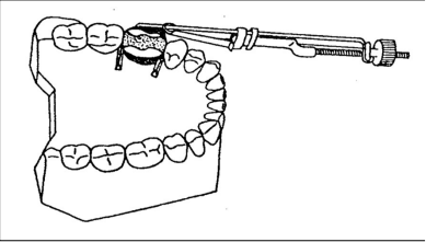 <p>which matrix band is this? </p>