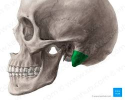 <p>What is this pointing to? What bone is it on?</p>