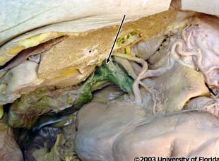 <p>what structure is being indicated to by the arrow?</p>