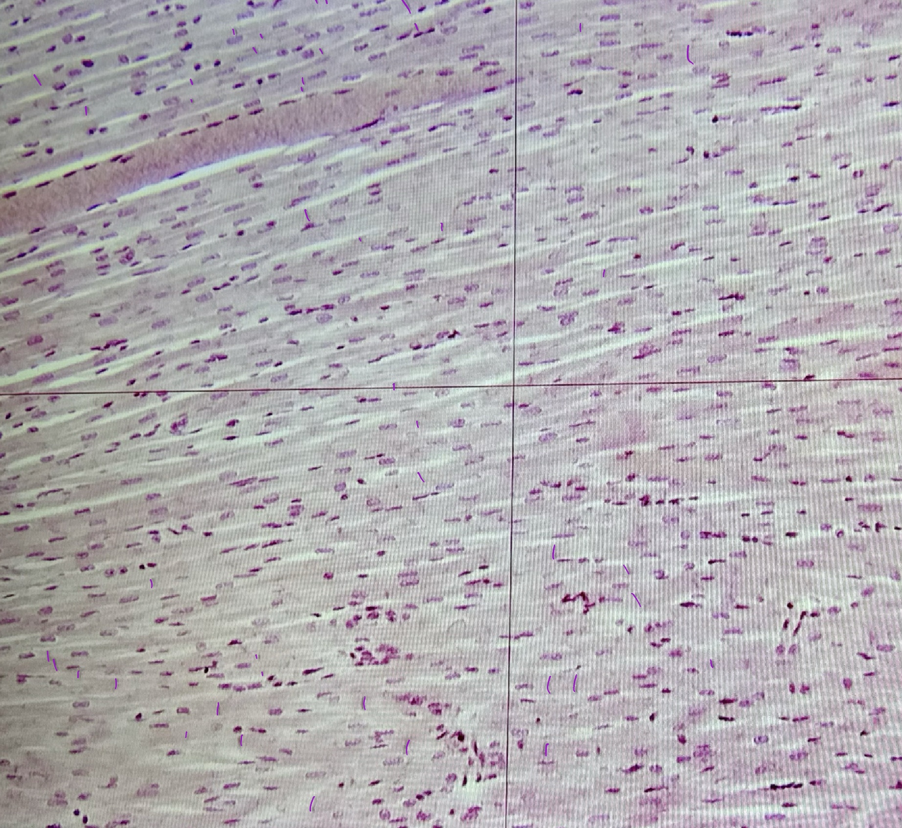 <p>cardiac muscle</p>