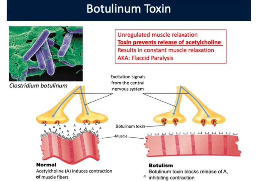 <p>Clostridium botulinum (Toxigenic Clostridial Pathogens)</p>