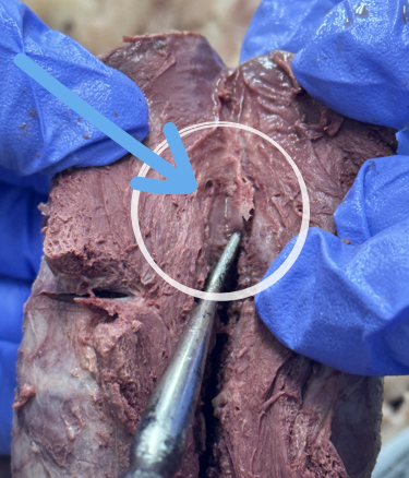 <p>navicular fossa</p>