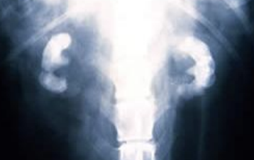 <p>What procedure is used to treat obstructive nephrolithiasis, and can be unilateral or bilateral? You can use the classic or the non-atrophic technique, and this will usually decrease overall renal function by 20-50% for that kidney. This refers to incising the kidney and removing the calcification. Catheterization is often involved in this procedure. Sutures are only made along the incision line, no mattress sutures can be used for this procedure.</p>