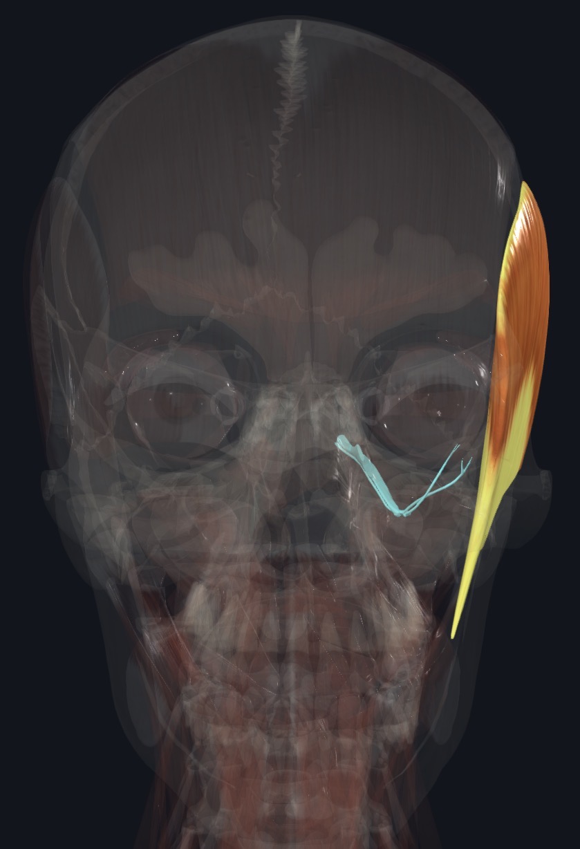 <p>Anterior trunk of mandibular N (CN V3) Via temporal branches</p>