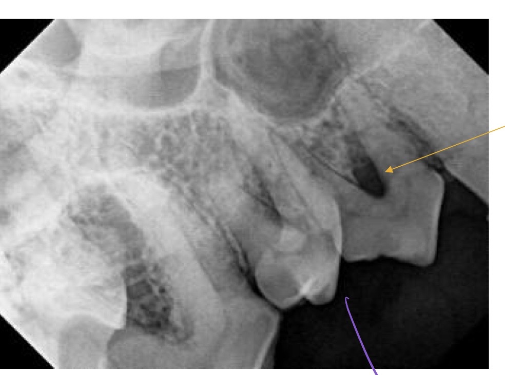 <p>what is the arrow pointing to?</p>