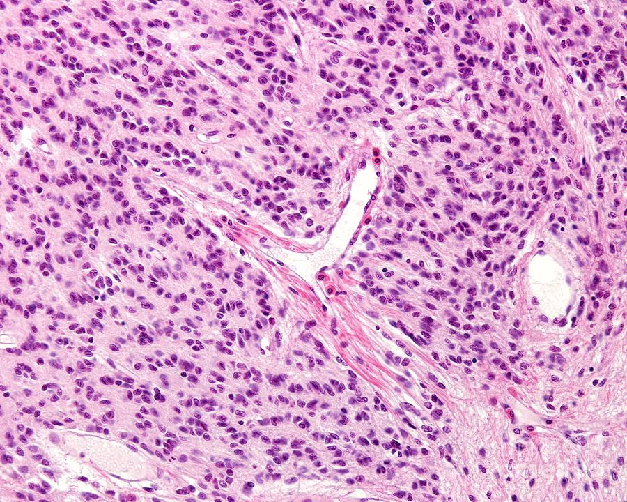 <p>What organ does this histology show?</p>