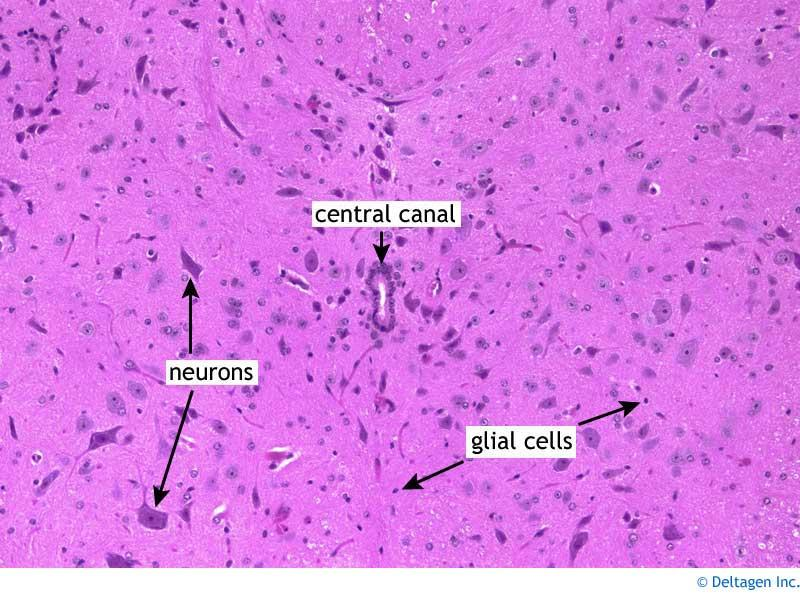 <p>Typically appears much smaller than a neuron, often seen as small dark nuclei around neurons.</p>