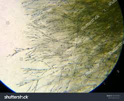 <p>Mass of hyphae</p>