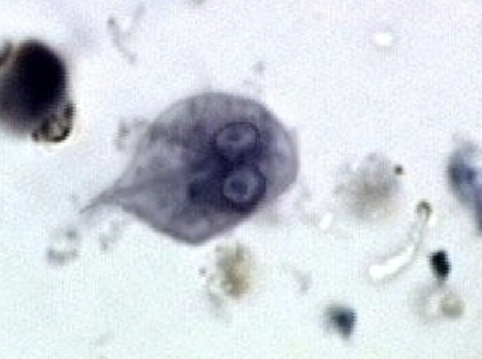 <p>What protist is this?</p>