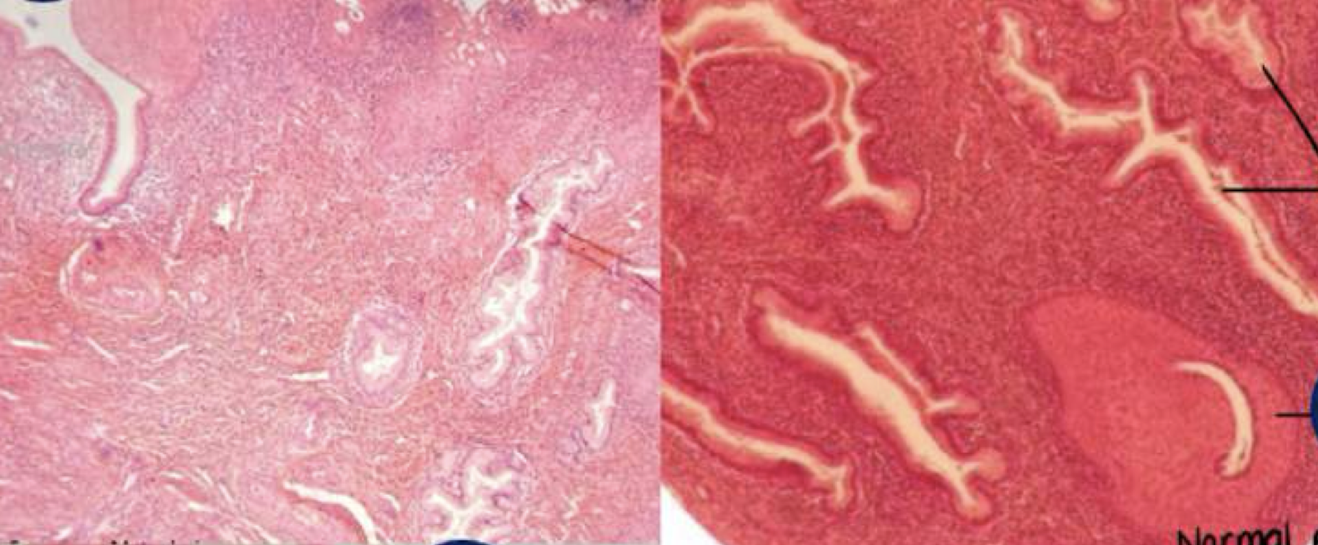 <p>Diagnose and identify metaplasmic change</p>