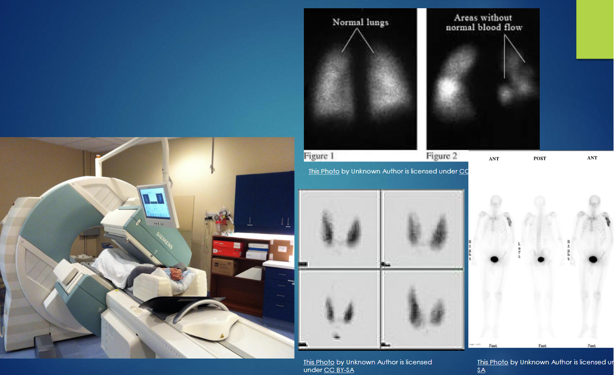 <p>uses tiny amounts of radioactive materials that are injected, inhaled or swallowed → therefore the patient is the source of radiation </p><ul><li><p>produces EMISSION images as opposed to transmission images</p><ul><li><p>this is because the radioisotopes emit their energy from inside the patient </p></li></ul></li></ul><p></p>