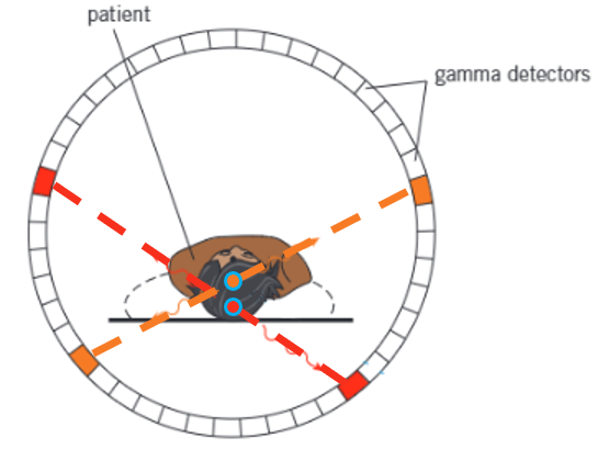 <ul><li><p>The gamma detectors send the signals to a computer when they detect a gamma particle</p></li><li><p>The point of annihilation is determined from the difference in the arrival times of pairs of photons at two opposite detectors</p></li><li><p>The computer uses these points of annihilation to form an image where different colours correspond to different concentrations of the tracer</p></li></ul><p></p>