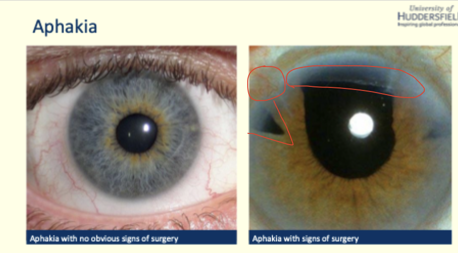 <p>describe and give diagnosis </p>