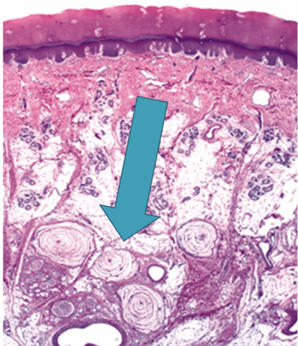 <p>Identify the structure</p>