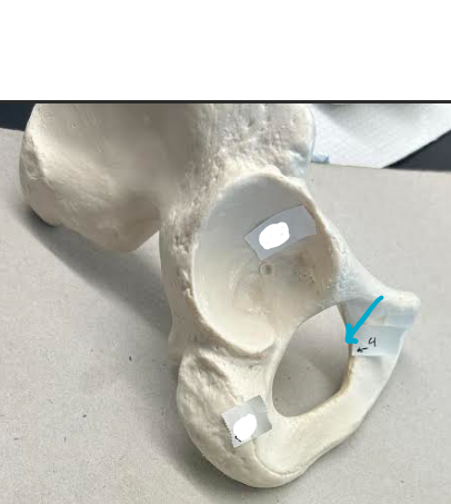 <p>ID Os Coxae hole region</p>