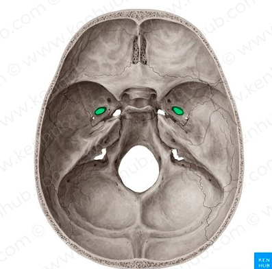 <p>Identify the structure pinned</p>