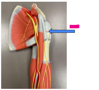 <p>What is the pink arrow?</p>