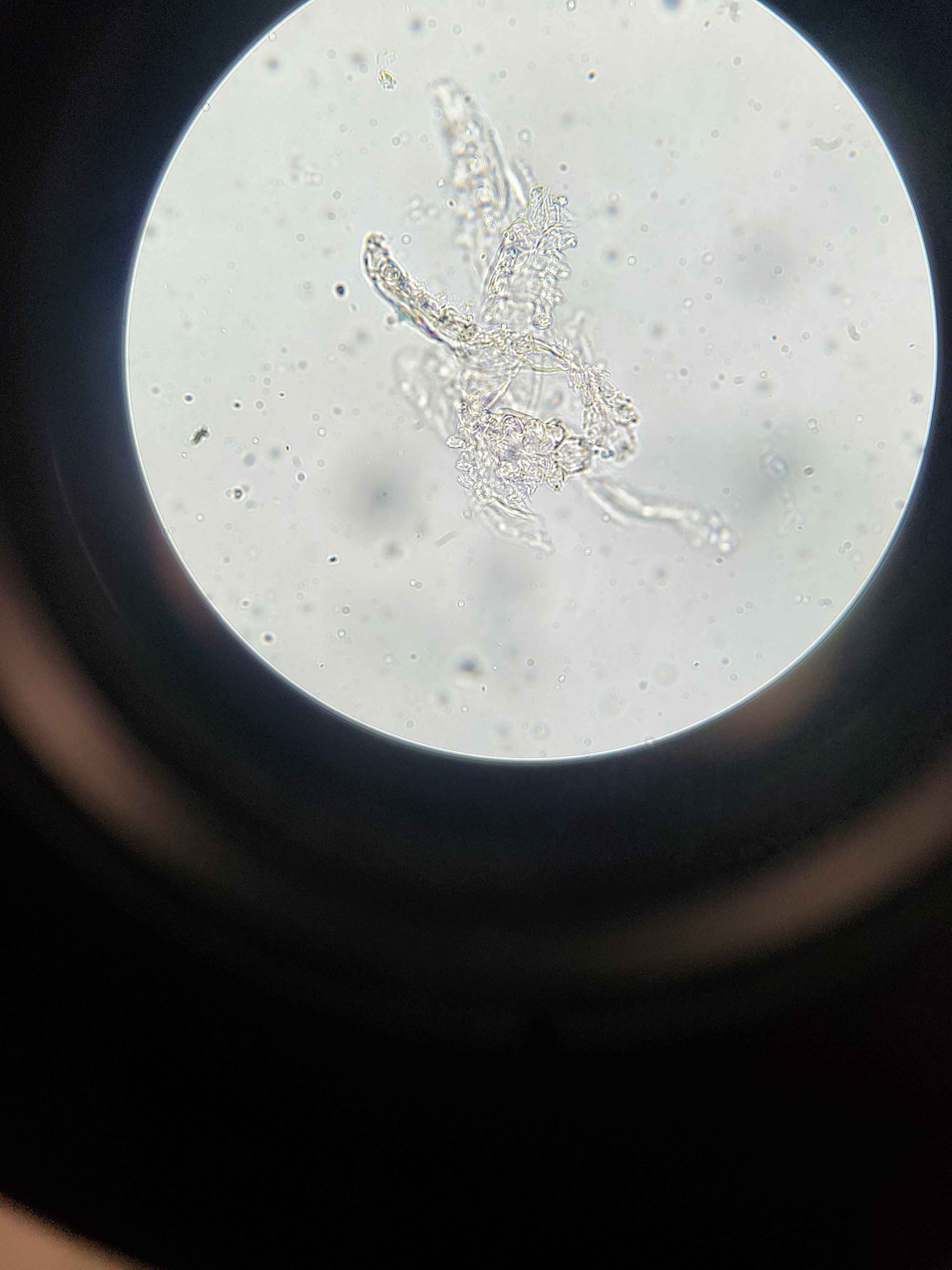 <p>Subphylum: Chelicerata</p><p>Class: Arachnida</p><p>Order: Trombidiformes - eyelash mites</p>