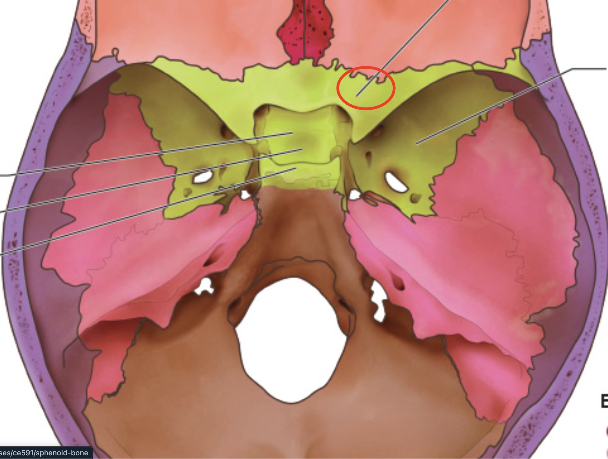 term image