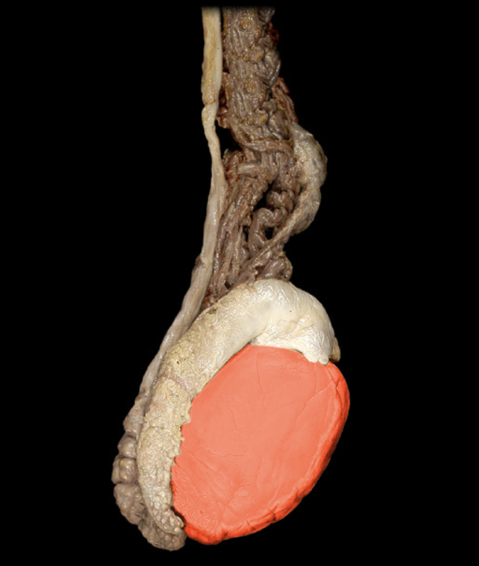 term image