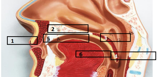 <p>Label this image.</p>