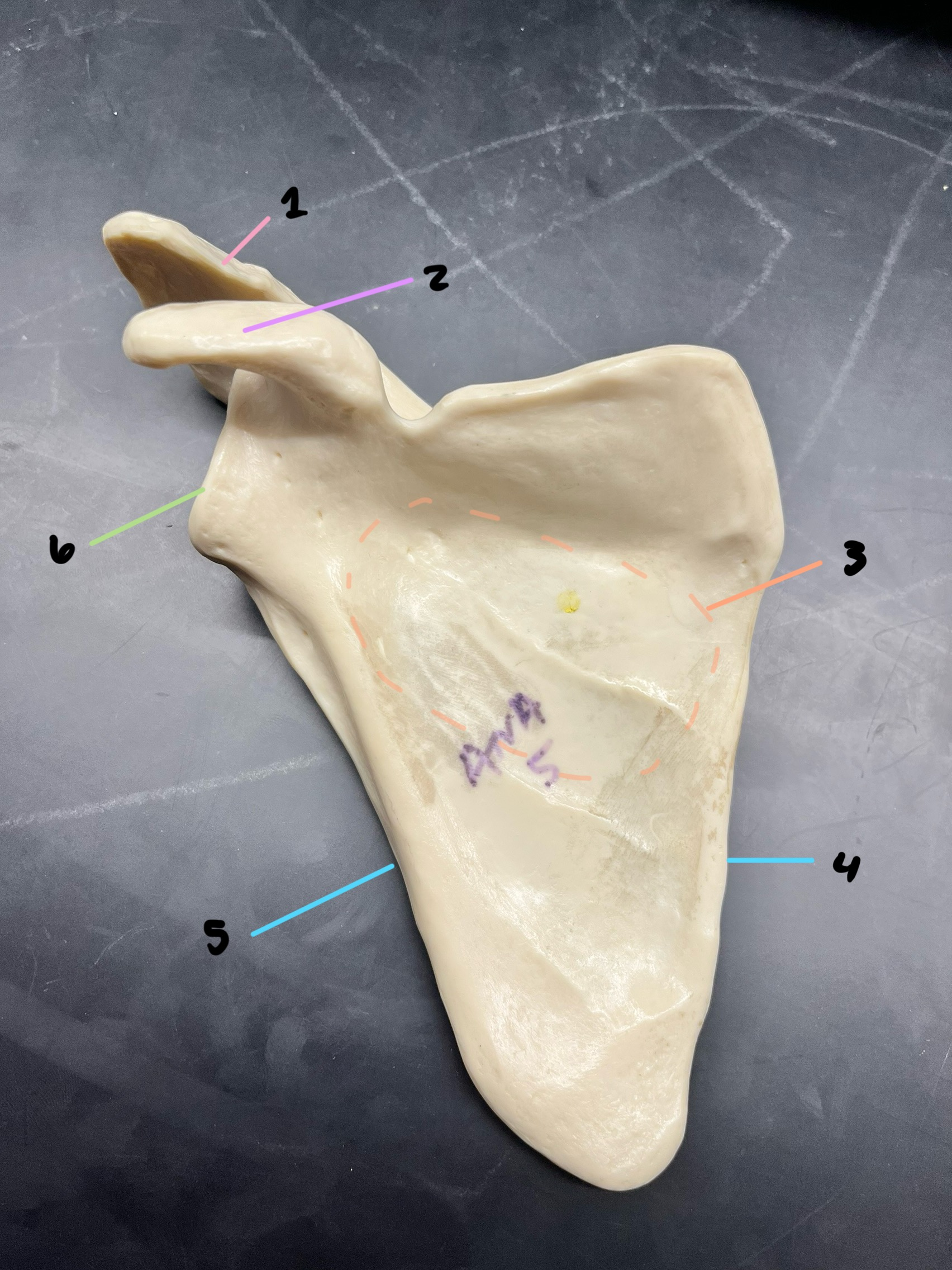 <p>what bone is this? give which side and if it is anterior or posterior</p>